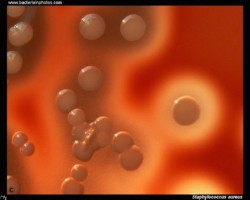 colonies of staph with a wide zone of beta hemolysis